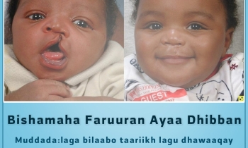 Free medical convoy for cleft lips